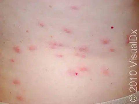 Bedwantsen beten - Breakfast lunch dinner pattern